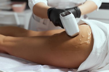 Genç Afrikalı kadın uyluklarına lazer kılı aldırıyor..