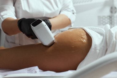 Genç Afrikalı kadın uyluklarına lazer kılı aldırıyor..