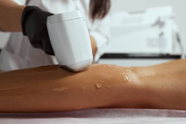 Genç Afrikalı kadın uyluklarına lazer kılı aldırıyor..