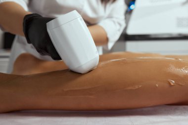 Genç Afrikalı kadın uyluklarına lazer kılı aldırıyor..