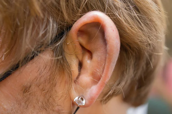 Ein Mann, dessen Ohr blutet. Gefäßruptur, Schäden am Trommelfell, Ohrerkrankungen, Onkologie, Mittelohrentzündung, Myringitis. — Stockfoto