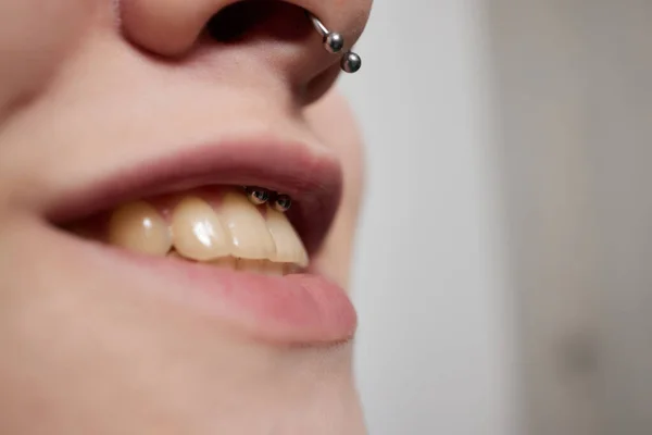Sonrisa o perforación de frenillo debajo del labio superior. —  Fotos de Stock