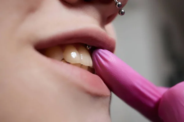 Sourire ou frenulum piercing sous la lèvre supérieure. — Photo