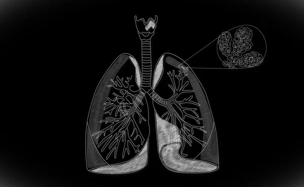 Estrutura pulmonar humana — Fotografia de Stock