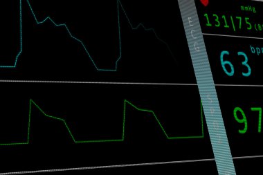 Kalp monitörü EKG Ekg