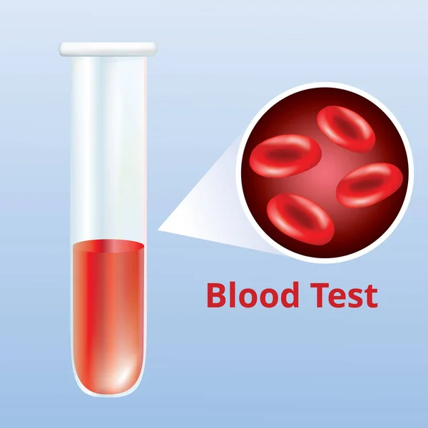 Анализ Крови Помощью Медицинской Трубки Эритроцитами Векторная Иллюстрация — стоковый вектор