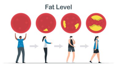 Kolesterol seviyesi. Kan damarlarında yağ tabakaları. Güçlü olan zayıf olur. Kardiyoloji vektör çizimi beyaz arkaplanda izole edildi.