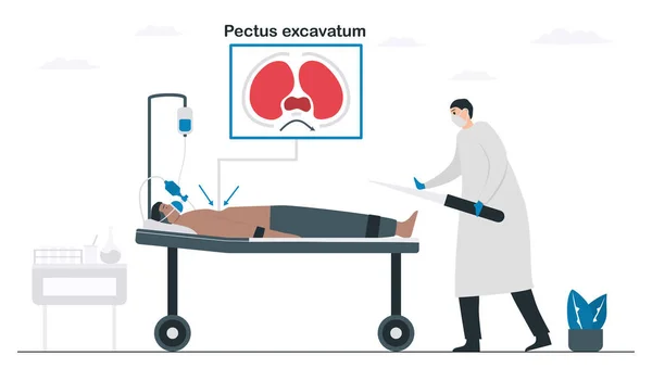 Médicos Estão Operar Paciente Que Pectus Excavatum Ilustração Vetor Pneumologia — Vetor de Stock