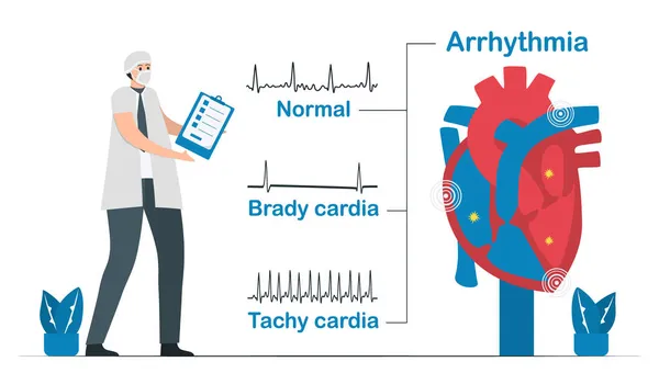 正常的心脏信号与2种类型的心律失常进行比较 它包括心动过速和心律失常 在白色背景下孤立的心脏病载体图解 — 图库矢量图片