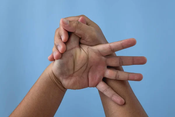 Concepto Síndrome Oficina Pulgar Dedo Masajea Estira Después Del Trabajo — Foto de Stock