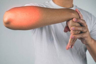 Tenis ve golften dirsek yaralanması. Adam masaj yapmak ve kolunu esnetmek için parmaklarını kullanıyor. Acı belirti bölgesi kırmızı renkle gösterilir. Sağlık hizmeti bilgisi. Orta yakın çekim.