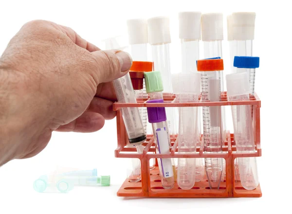 Closeup of a hand placing a test tube — Stock Photo, Image