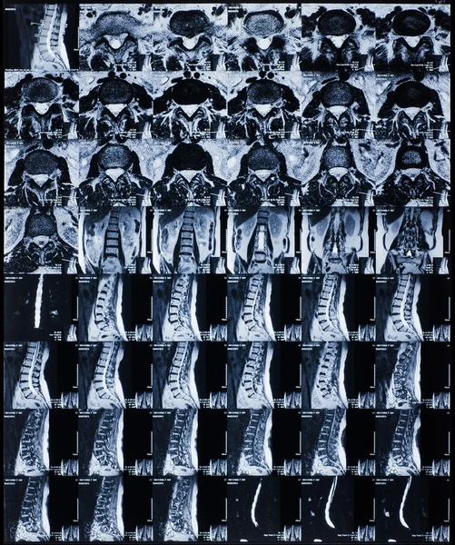 MRI — Stock Image MRI Stock Photo