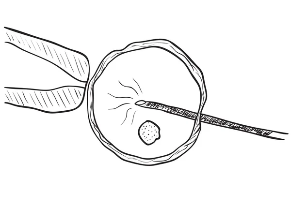 Dibujo de inseminación in vitro — Archivo Imágenes Vectoriales