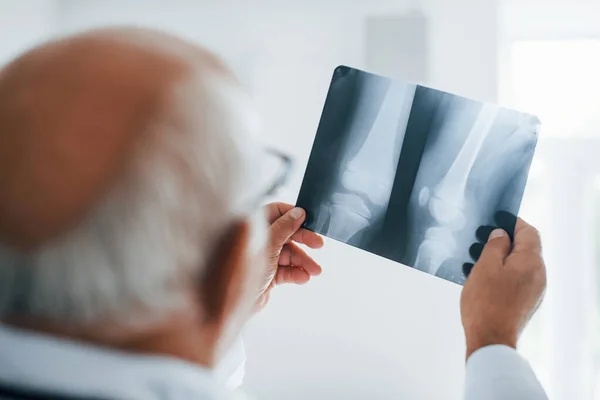 Beyaz Üniformalı Kıdemli Doktor Insan Bacağının Röntgenini Inceliyor — Stok fotoğraf