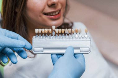 Dişçi diş beyazlatma seviyesini renklerle kontrol ediyor. Genç yetişkin bir kadın kliniği ziyaret ediyor..