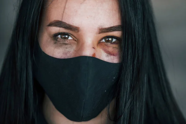 Portrait Beaten Young Woman Black Protective Mask Bruise Eye Indoors — Stockfoto