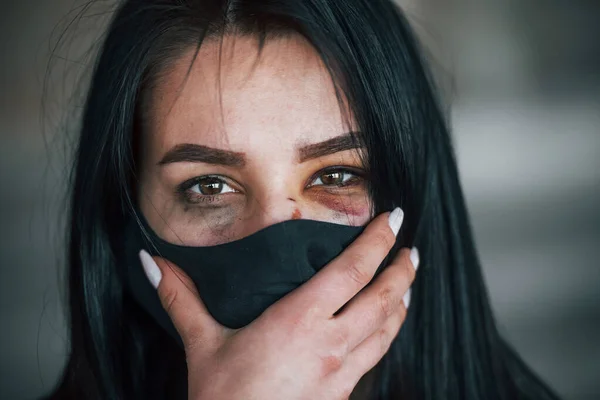 Portrait Beaten Young Woman Black Protective Mask Bruise Eye Indoors — Stock Fotó