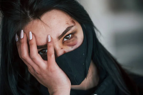 Portrait Beaten Young Woman Black Protective Mask Bruise Eye Indoors — Stockfoto