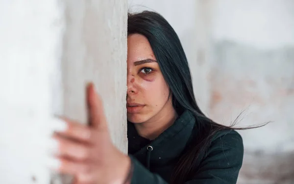 Portrait Beaten Young Woman Bruise Eye Standing Leaning Wall Indoors — Stok fotoğraf