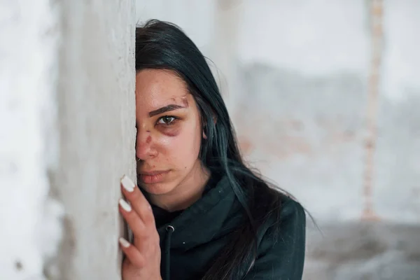 Gözlerinin Altında Çürükle Dövülmüş Genç Bir Kadının Portresi Terk Edilmiş — Stok fotoğraf