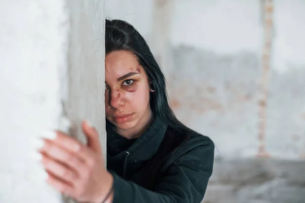 Gözlerinin Altında Çürükle Dövülmüş Genç Bir Kadının Portresi Terk Edilmiş — Stok fotoğraf