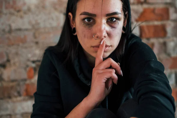 Portrait Beaten Young Woman Bruise Eye Shows Silence Gesture Finger — Stok fotoğraf