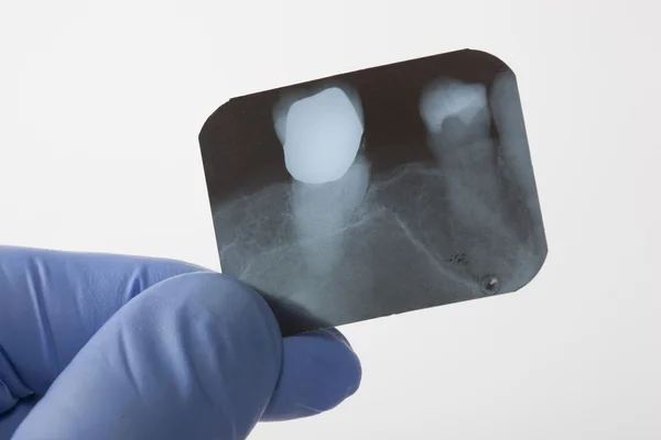 Looking a x - ray of tooth Stock Photo