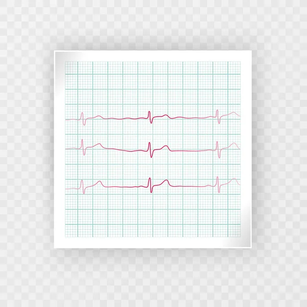 Ekg Herzschlag Und Herzfrequenzmessung Vektorformat — Stockvektor