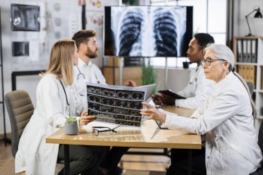 Laboratuvar önlüklü çok ırklı doktorlar modern konferans odasındaki masada otururken hastanın tomografisini tartışıyorlar. Modern TV ekranında akciğerlerin röntgenini inceleyen bir grup tıp uzmanı..