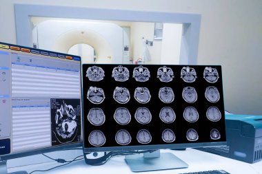 Tomografi kontrol odası ve bilgisayar beyin taraması gösteriyor. Tıbbi teknoloji konsepti.