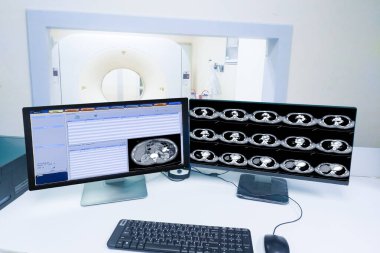 Bilgisayar monitörü kontrol odası ve bilgisayar karın taraması, tıbbi teknoloji konsepti gösteriyor.