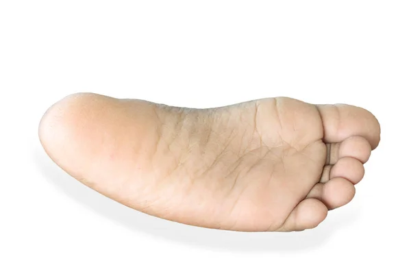 Dry Dirty Child Bare Feet White Background — Stock Photo, Image