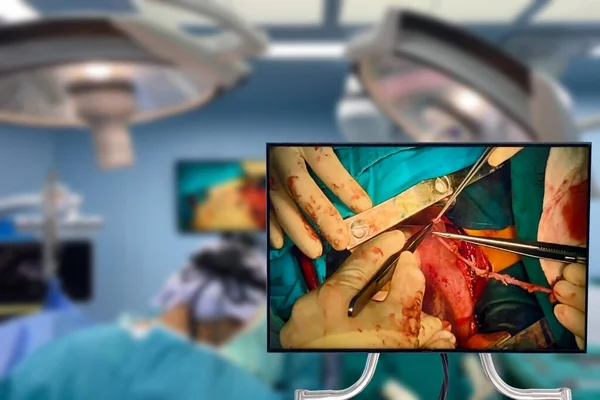 Abstract Blur Medical Team Voert Chirurgische Operatie Uit Het Ziekenhuis — Stockfoto