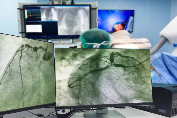 Angiogramma Coronarico Cag Monitor Lcd Offuscamento Del Moderno Laboratorio Cath — Foto Stock