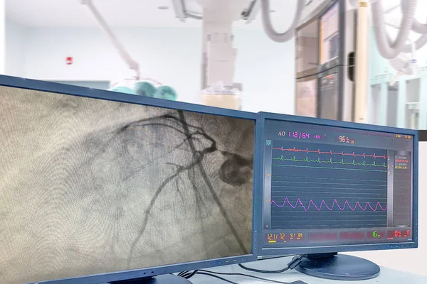 Современный Cath Lab Показывает Жидкокристаллический Монитор Врачом Медсестрой Пациентом Больнице — стоковое фото