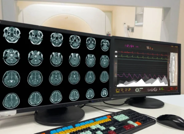 Motion Blur Medical Mri Pet Brain Scan Film Computer Monitor — стоковое фото