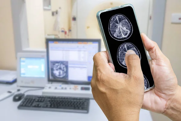 Doktor Hastanın Beyin Sonuçlarını Kontrol Etmek Için Bir Cep Telefonu — Stok fotoğraf