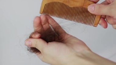 Tarak elinde ve saçı var. Saç dökülme sorunu, hormonal bozukluk, stres, diyet, kafa derisi ve saç ampülü hastalığı..