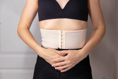 Doğumdan sonra Diastasis Recti. Karın bölgesini desteklemek için korse takan bir kadın. Kilo vermek için spor ve diyet. Vücudun genç kadın tarafından görünüşü