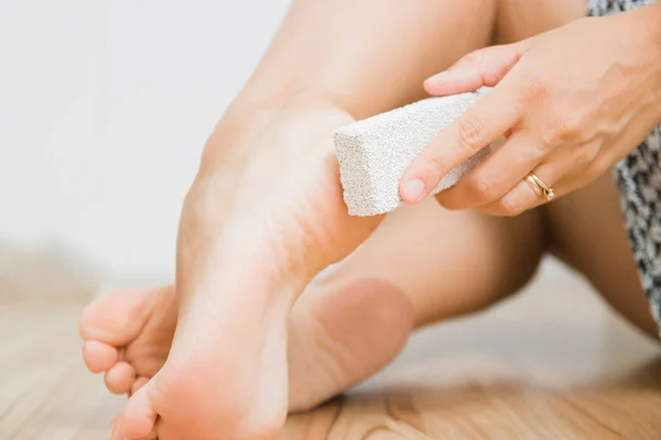 The dry skin on the heel is cracked. Closeup dehydrated skin on the heels of female feet. Treatment concept with moisturizing creams and exfoliation for healing wounds and pain when walking