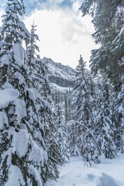 Banff Park 'ta Louise Gölü, Alberta, Kanada
