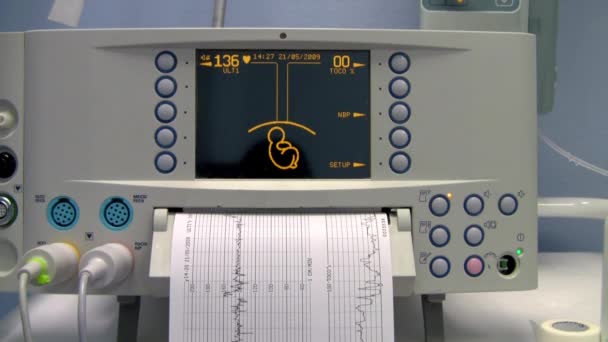 Medicinsk utrustning ultraljud genomsökning. graviditet. — Stockvideo
