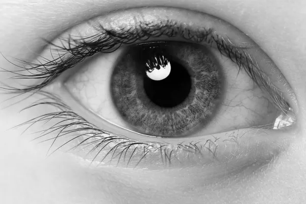 รูปแมโครของดวงตาผู้หญิงที่มีหลอดเลือดแดง ตาสีแดงหลังจากมีไข้ฟางโจมตี — ภาพถ่ายสต็อก