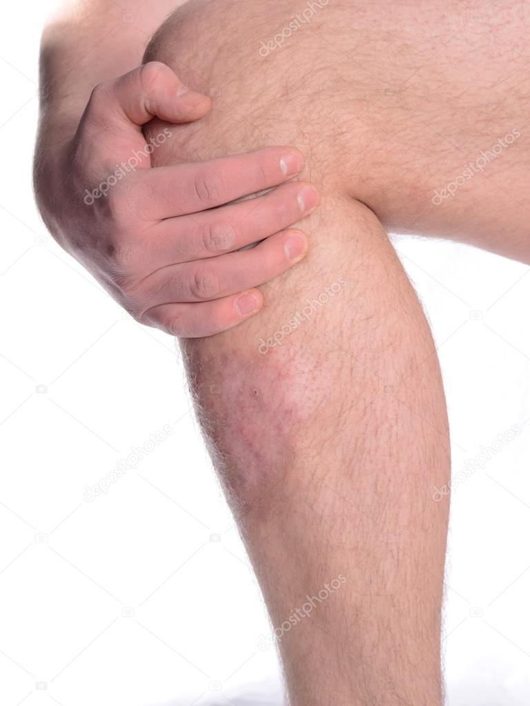 Maladie De Peau Images Libres De Droit Photos De Maladie De Peau Depositphotos