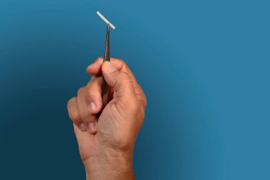 Hormonal implant veya güzellik çipi deri altı bir uygulamadır..