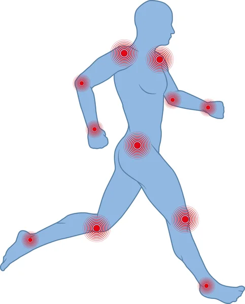 Dolor articular — Vector de stock