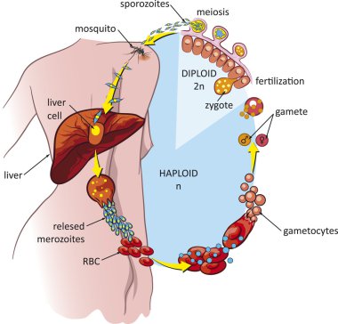 Malaria clipart