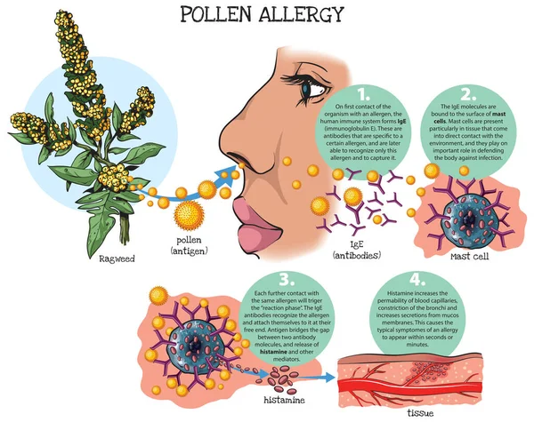 Ilustración Vectorial Respuesta Del Sistema Inmunitario Alergia Polen — Vector de stock