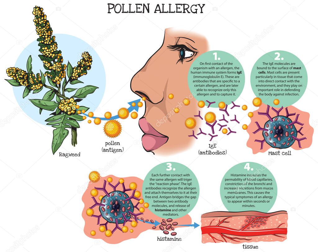 Vector illustration of the response of the immune system to pollen allergy